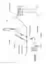 Fig. 05 - Methods for enhancing fluid flow through an obstructed vascular site, and systems and kits for use in practicing the same