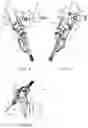 Fig. 04 - Robotic arm with five-bar spherical linkage