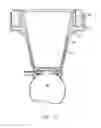 Fig. 04 - System for ophthalmic laser surgery