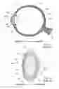Fig. 02 - System and method for treating the structure of the human lens with a laser