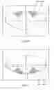 Fig. 23 - System and method for treating the structure of the human lens with a laser