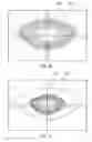Fig. 26 - System and method for treating the structure of the human lens with a laser