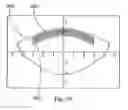 Fig. 30 - System and method for treating the structure of the human lens with a laser