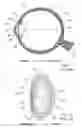 Fig. 02 - System and apparatus for treating the lens of an eye