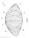 Fig. 12 - System and apparatus for treating the lens of an eye