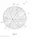 Fig. 13 - System and apparatus for treating the lens of an eye