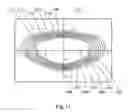 Fig. 25 - System and apparatus for treating the lens of an eye