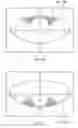 Fig. 27 - System and apparatus for treating the lens of an eye