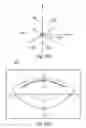 Fig. 32 - System and apparatus for treating the lens of an eye