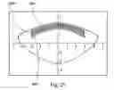 Fig. 34 - System and apparatus for treating the lens of an eye