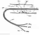 Fig. 01 - Minimally invasive methods for thermal treatment