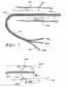 Fig. 05 - Minimally invasive methods for thermal treatment