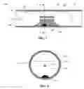Fig. 08 - Minimally invasive methods for thermal treatment