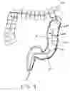 Fig. 09 - Minimally invasive methods for thermal treatment
