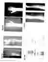 Fig. 28 - Method, members, system and program for bone correction