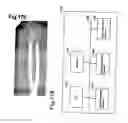 Fig. 47 - Method, members, system and program for bone correction