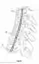 Fig. 05 - Device for aligning a human or animal vertebral column