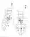 Fig. 04 - Method of percutaneous paracoccygeal pre-sacral stabilization of a failed artificial disc replacement