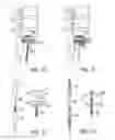 Fig. 06 - Method of percutaneous paracoccygeal pre-sacral stabilization of a failed artificial disc replacement