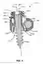 Fig. 05 - Adjustable connector for attachment to a rod in a medical application