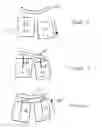 Fig. 04 - Spondylolistheses correction system and method of correcting spondylolistheses