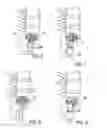 Fig. 05 - Method of percutaneous paracoccygeal pre-sacral stabilization of a failed artificial disc replacement