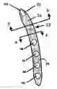 Fig. 01 - Intramedullary implant for fracture fixation and method of using the same