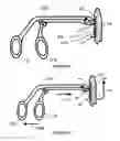 Fig. 15 - Intramedullary implant for fracture fixation and method of using the same