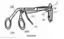 Fig. 17 - Intramedullary implant for fracture fixation and method of using the same
