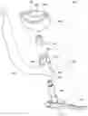 Fig. 01 - Targeting device for bone implant