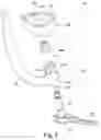Fig. 03 - Targeting device for bone implant