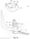 Fig. 06 - Targeting device for bone implant