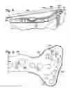 Fig. 04 - Bone plate with cover