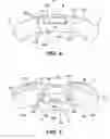 Fig. 05 - Adjustable bone plate