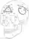 Fig. 01 - Craniotomy closures and plugs