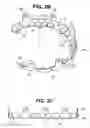 Fig. 04 - Craniotomy closures and plugs