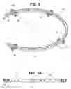 Fig. 05 - Craniotomy closures and plugs