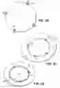 Fig. 06 - Craniotomy closures and plugs