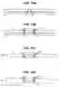 Fig. 22 - Craniotomy closures and plugs