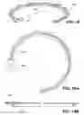 Fig. 26 - Craniotomy closures and plugs