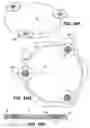 Fig. 40 - Craniotomy closures and plugs