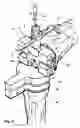 Fig. 03 - Bone jig