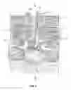 Fig. 03 - System and Method for Centering Surgical Cutting Tools About the Spinous Process or Other Bone Structure