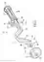 Fig. 02 - Split thread orthopaedic implant impactor