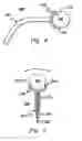 Fig. 04 - Surgical tool and method employing vacuum coupling or magnetic coupling engagement mechanism for facilitating positioning of an intervertebral device