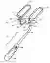 Fig. 01 - Apparatus and Method for Sculpting the Surface of a Joint