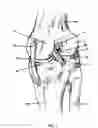 Fig. 02 - Apparatus and Method for Sculpting the Surface of a Joint