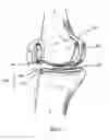 Fig. 09 - Apparatus and Method for Sculpting the Surface of a Joint