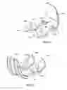 Fig. 24 - Apparatus and Method for Sculpting the Surface of a Joint