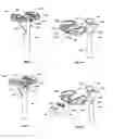 Fig. 29 - Apparatus and Method for Sculpting the Surface of a Joint